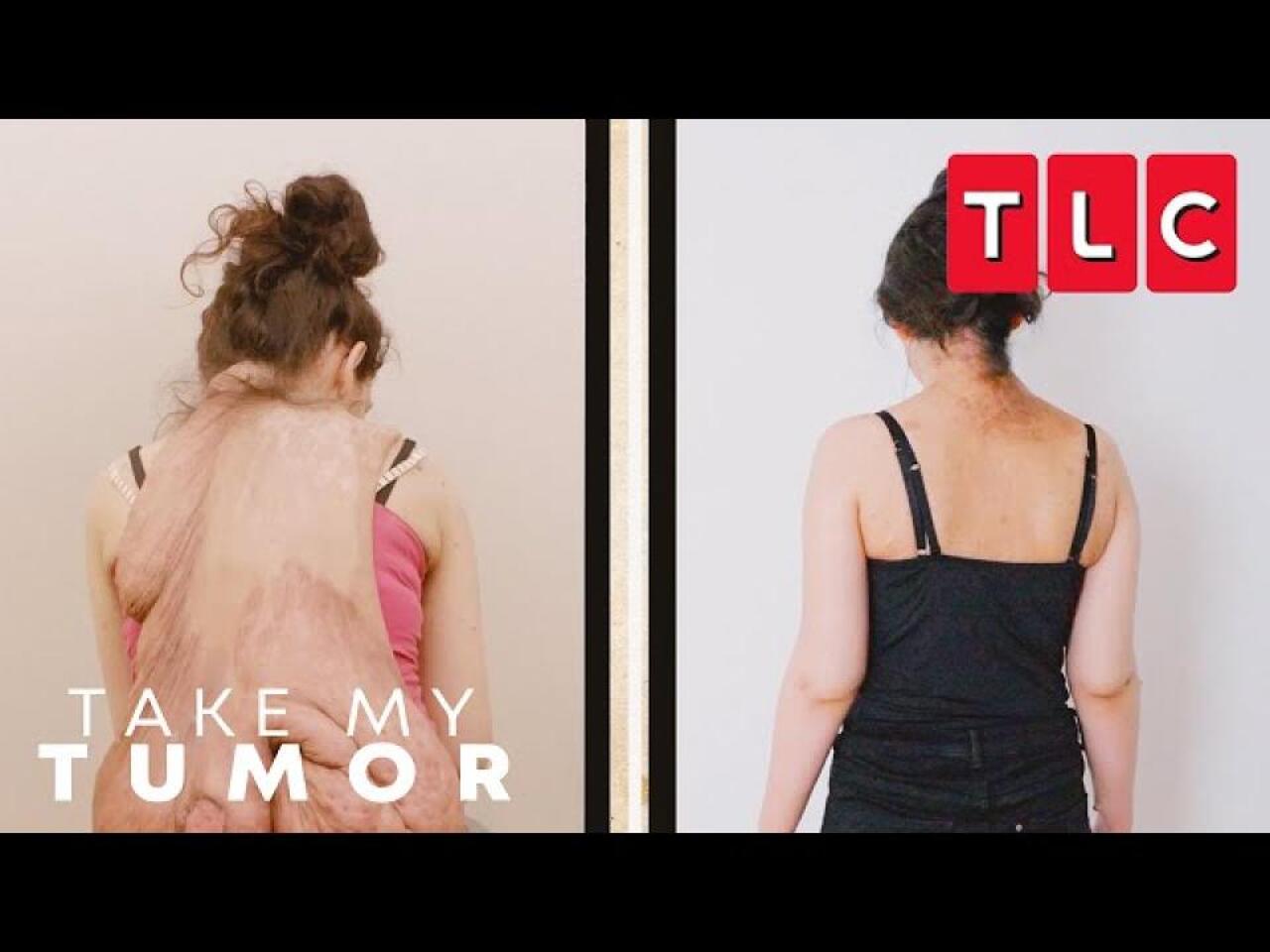 Take My Tumor / 17.05.2025, 02:00